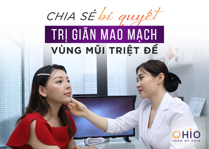 Chia sẻ bí quyết trị giãn mao mạch vùng mũi triệt để