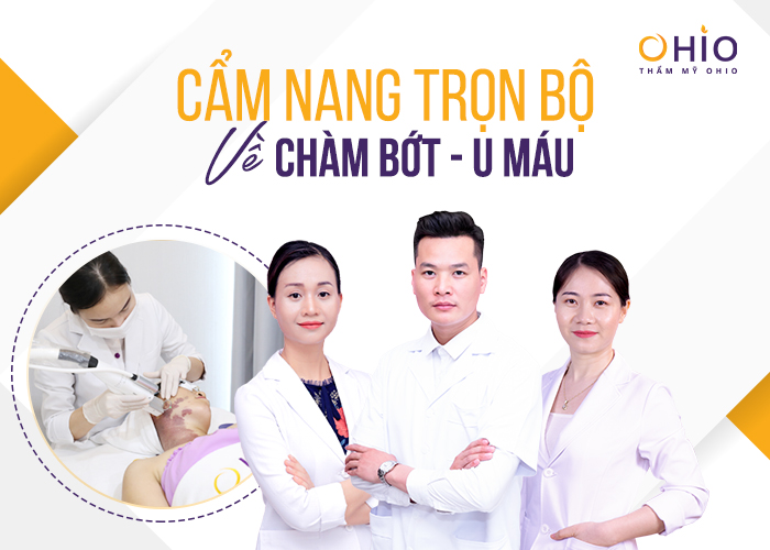 Tìm hiểu thông tin về chàm bớt đỏ u máu