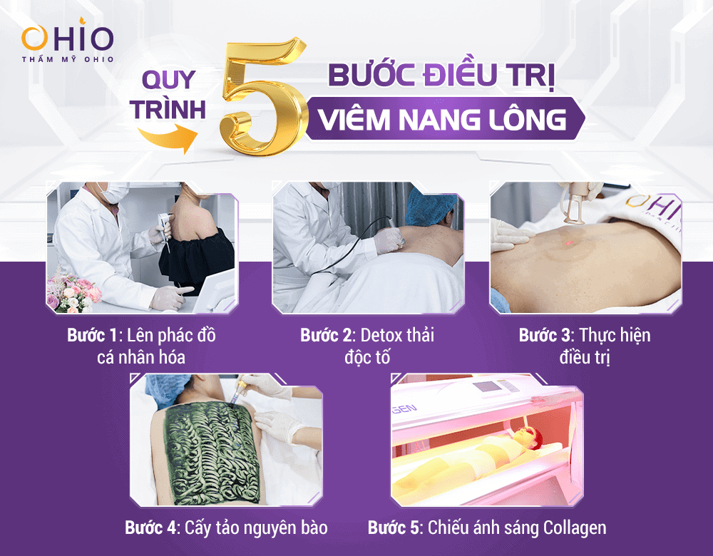 Viêm nang lông 5